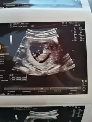 WhatsApp Image 2019-08-26 at 12.54.05 (2).webp