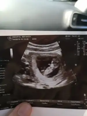 WhatsApp Image 2019-08-26 at 12.54.05.webp