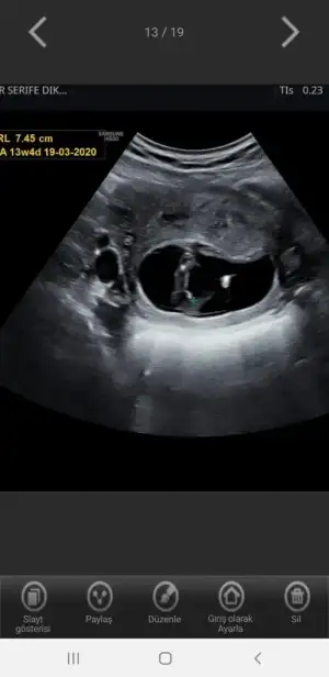 Screenshot_20190921-095417_Hello Mom.webp