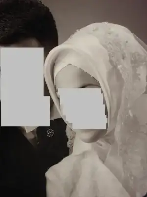 $ic bone capraz.webp