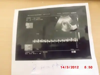 $G&#214;BEK 026.webp