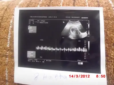 $G&#214;BEK 024.webp