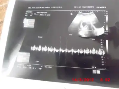 $G&#214;BEK 025.webp