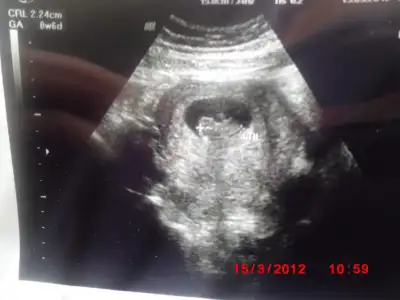 $G&#214;BEK 031.webp