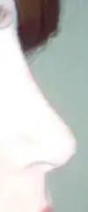 $resized_rinop_014.webp