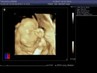 $20100320110957671.webp