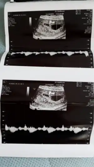 IMG-20191115-WA0004.webp