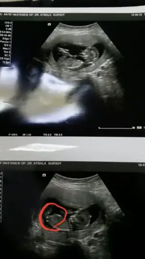 2019-12-21 16.41.12.webp