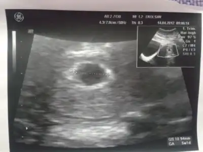 $2012-04-19 19.27.55.webp