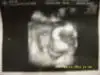 $th_921865629_SS855302_122_1159lo.webp