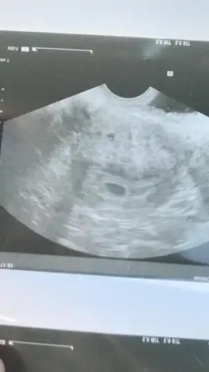 WhatsApp Image 2020-01-25 at 09.01.19.webp