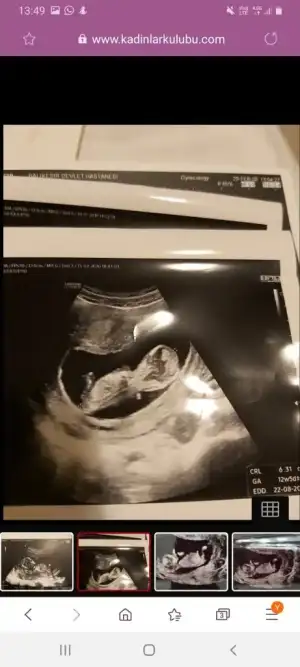 Screenshot_20200303-134932_Samsung Internet.webp