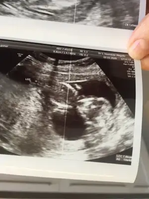 D8BA6724-ECAC-4CDE-9D3D-ECFEE2081E3C (1).webp