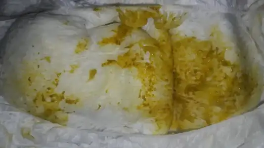 sezeryan izi fotoğrafları