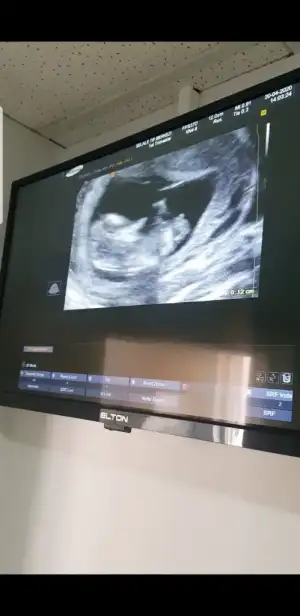 Screenshot_20200422-224138_Video Player.webp