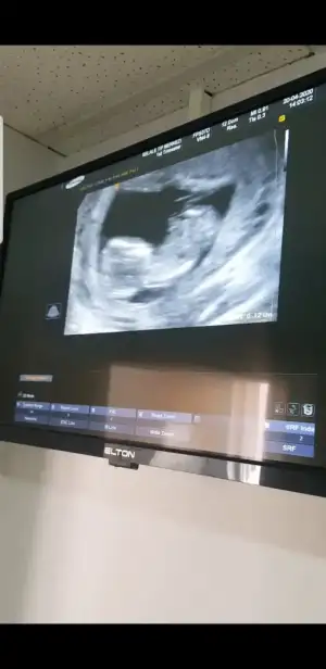 Screenshot_20200422-223911_Video Player.webp