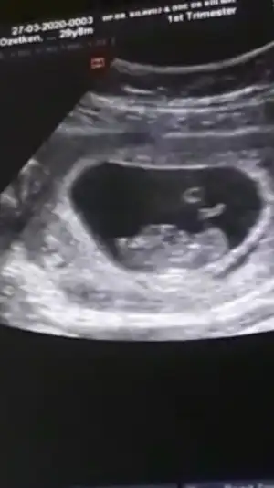 Screenshot_20200507-094420_Video Player.webp