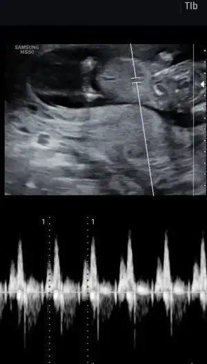 8D8B5252-A5B6-48D2-B9F4-F1DB57A8A20D.webp 8D8B5252-A5B6-48D2-B9F4-F1DB57A8A20D.webp