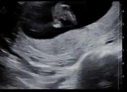 0F34E68A-5766-4A2F-8A9C-A0E5C7DF57A7.webp 0F34E68A-5766-4A2F-8A9C-A0E5C7DF57A7.webp