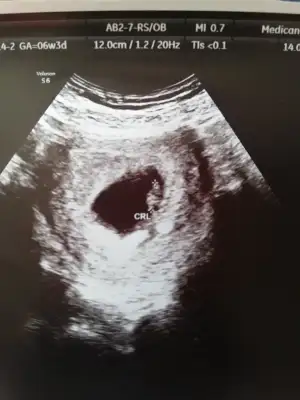 IMG_20200818_162617.webp IMG_20200818_162617.webp