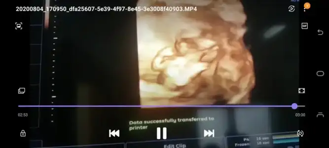 Screenshot_20200826-145824_Video Player.webp