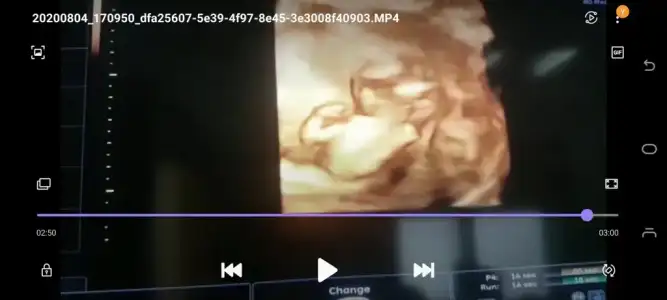 Screenshot_20200826-145815_Video Player.webp