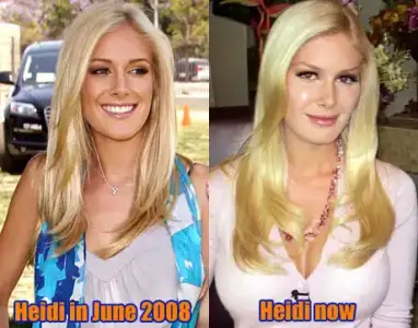 $heidi-new-face4.webp $heidi-new-face4.webp