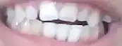 $di&#351;&#351;&#351;&#351;&#351;&#351;&#351;.webp
