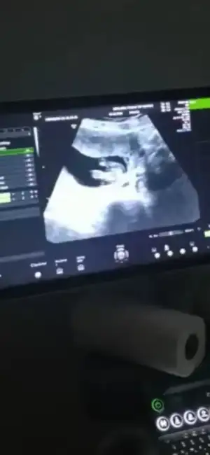 Screenshot_20201024-152225_Video Player.webp