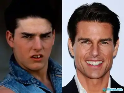 $tom-cruise-before-after1.webp