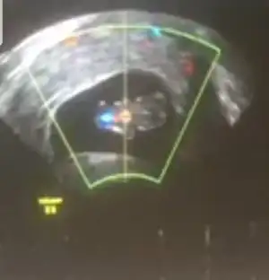 Screenshot_20201104-153041_Video Player.webp