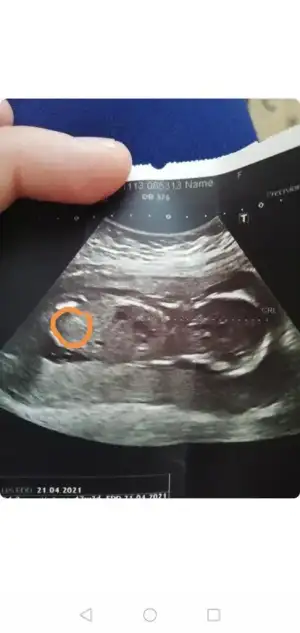 Screenshot_20201115_145602.webp