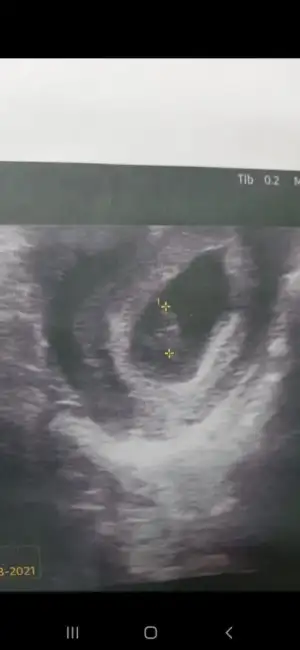 Screenshot_20201224-004357_Gallery.webp