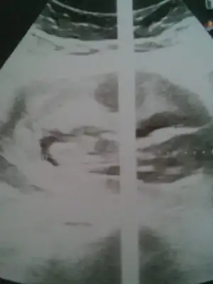 20201224_134801.webp