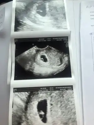 WhatsApp Image 2021-01-10 at 21.53.59.webp