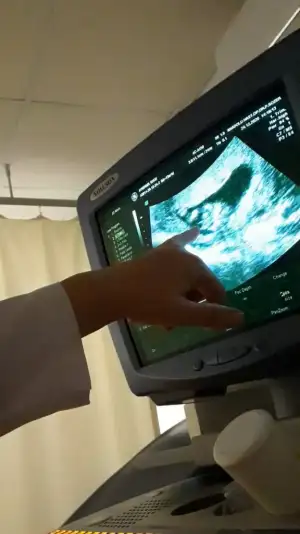 Screenshot_20210123-083911_Video Player.webp