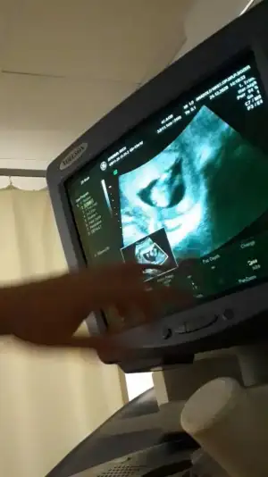 Screenshot_20210123-083543_Video Player.webp