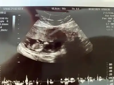 WhatsApp Image 2021-02-03 at 11.18.20.webp