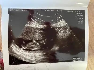 WhatsApp Image 2021-02-03 at 11.18.19.webp