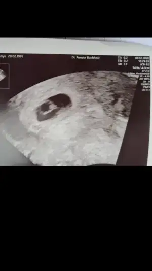 Screenshot_20210224-165401_Gallery.webp