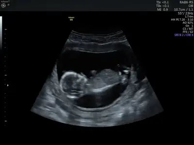 WhatsApp Image 2021-02-15 at 13.55.43.webp