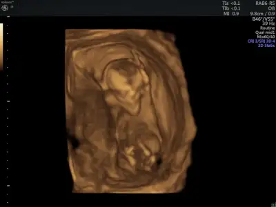 WhatsApp Image 2021-02-26 at 21.57.40.webp