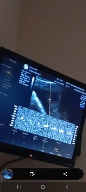 Screenshot_20210330-164210_Video Player.webp