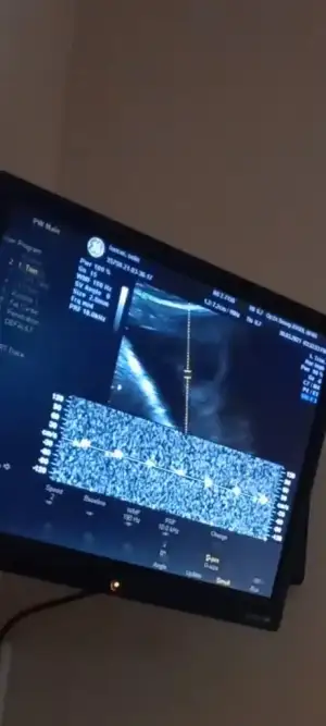 Screenshot_20210330-164207_Video Player.webp