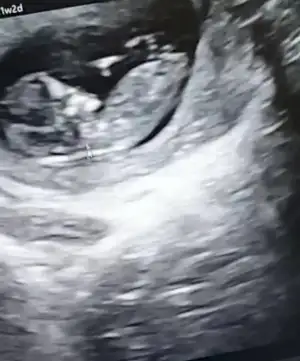 Screenshot_20210409-162230_Video Player.webp