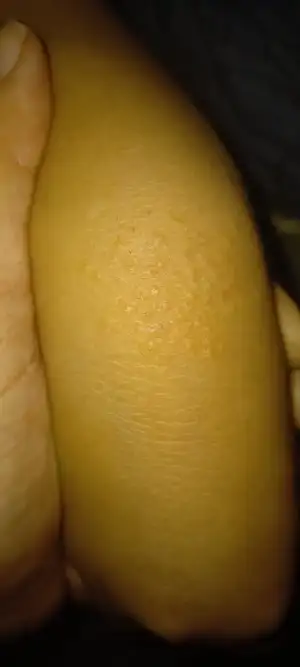 20210415_192436.webp