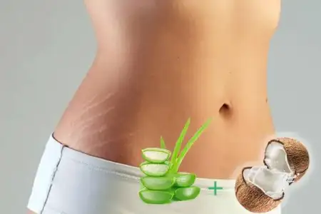 Aloe Vera Jeli Çatlaklara Nasıl Kullanılır? 10 Çatlak Maskesi Tarifi