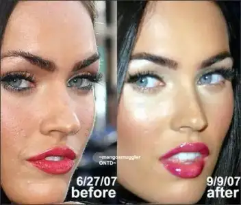 $megan-fox-nose-job0.webp