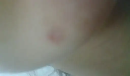 $G&#246;r&#252;nt&#252;0886.webp