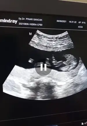Screenshot_20210806-185106_1.webp